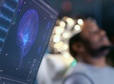 Stock image - brain stimulation